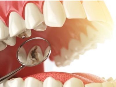 Empaste dental